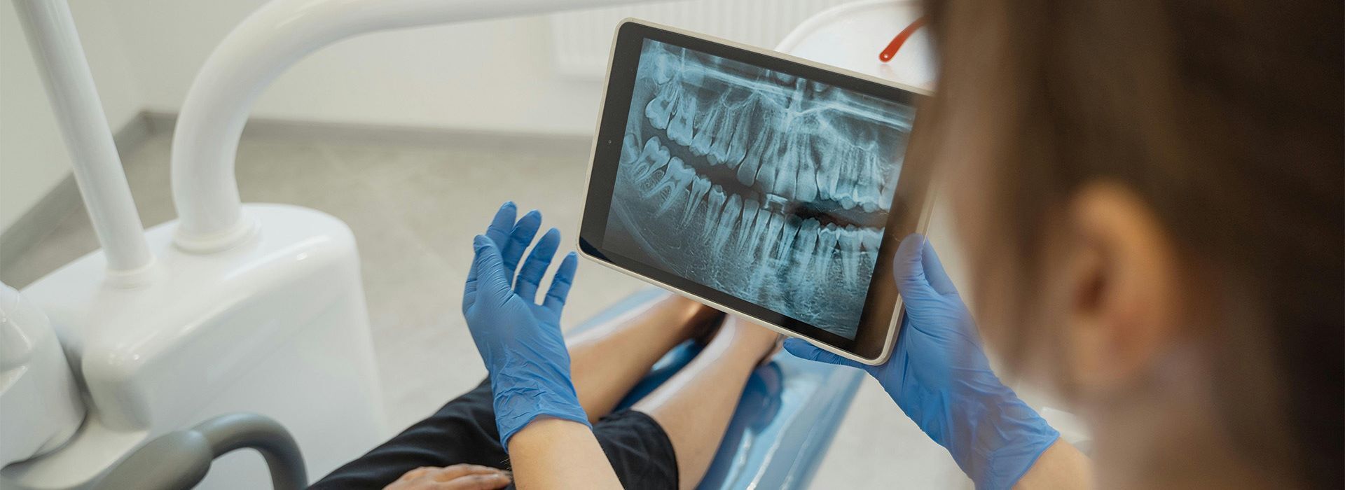 dentist showing patient an xray of their teeth